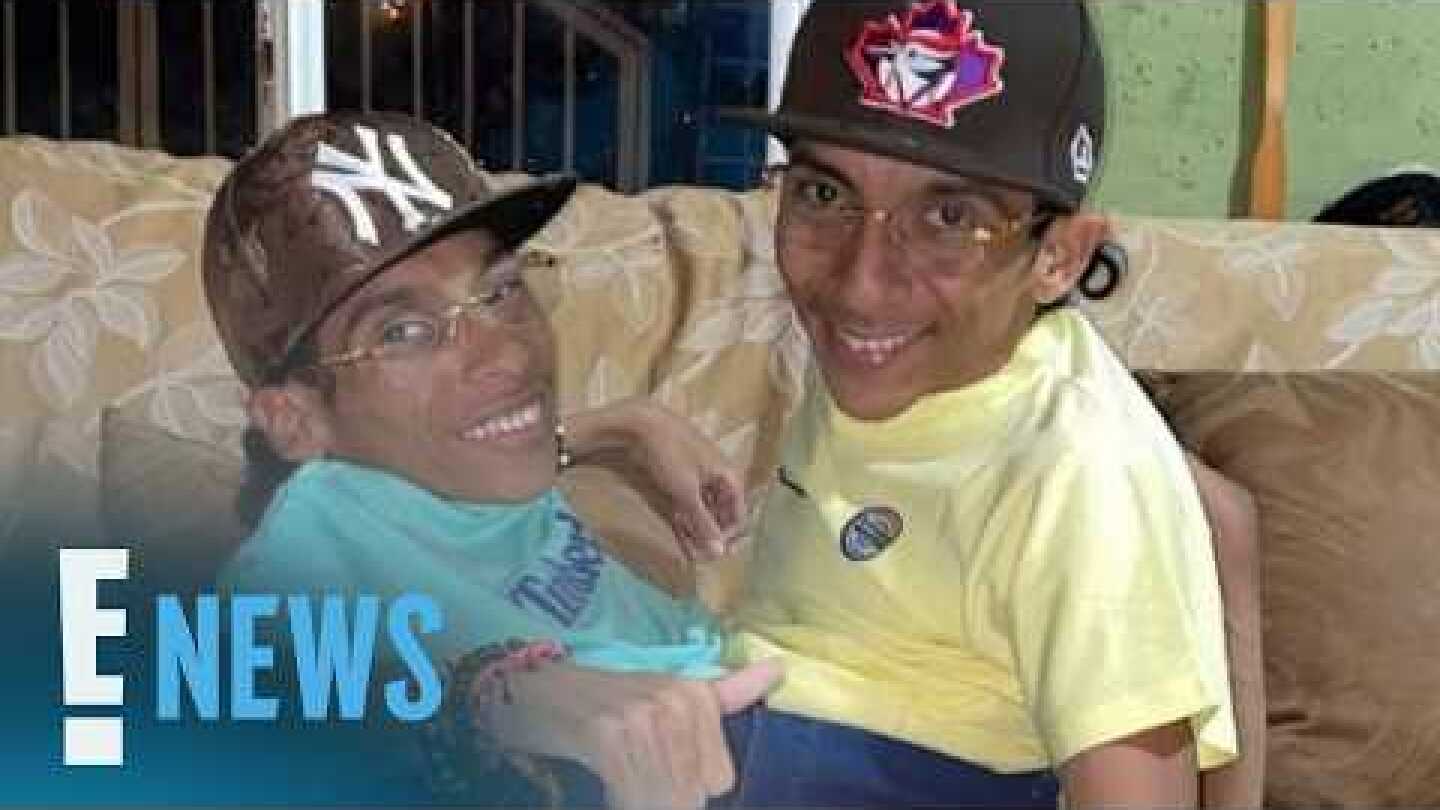 Conjoined Twins José Luis, José Armando Cevallos Dead at 27 | E! News