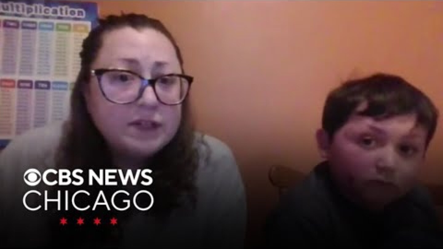 Plainfield mother warns about latest TikTok trend that severely burned her son
