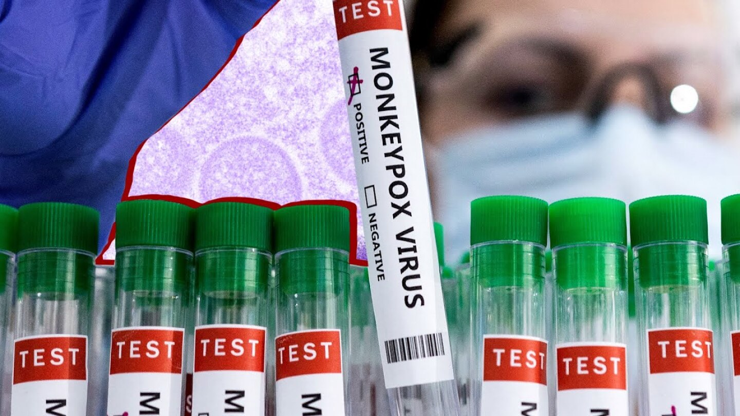 Monkeypox: what is it and how worried should we be?