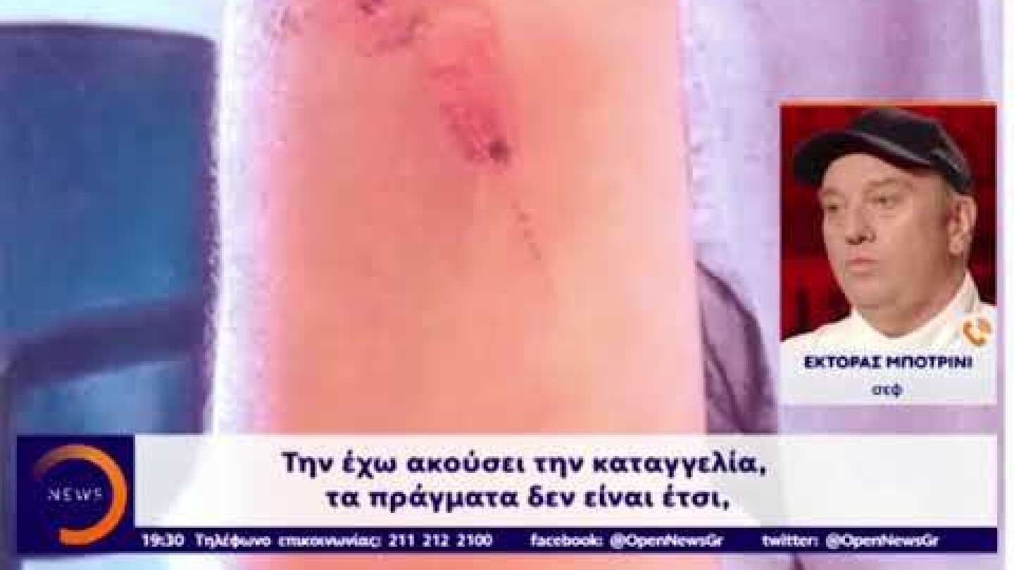 Δελτίο ΟΡΕΝ η κουζίνα κόλαση