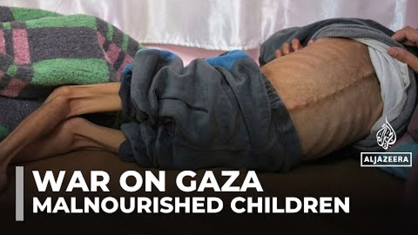 17,000 children in Gaza severely malnourished as starvation deaths rise