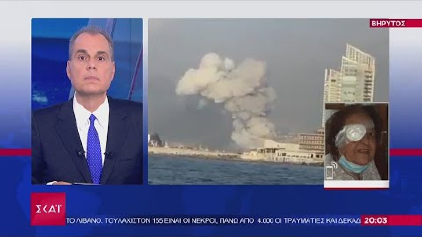 Ειδήσεις | Συγκλονιστική μαρτυρία Ελληνίδας τραυματία: Έχασα το μάτι μου από την έκρηξη | 05/08/2020