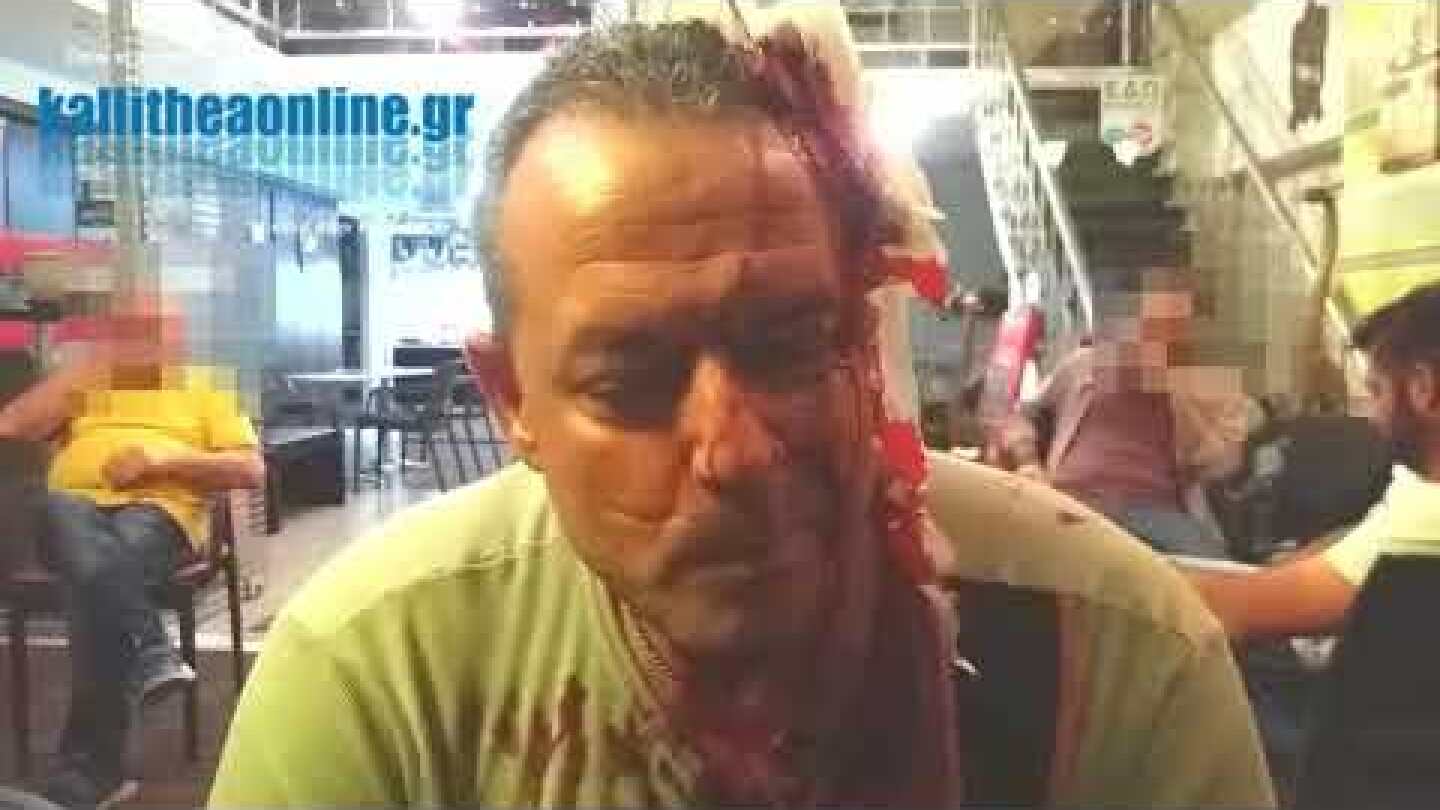 Θύμα φονικής επίθεσης ο φύλακας του πάρκου Δαβάκη στην Καλλιθέα