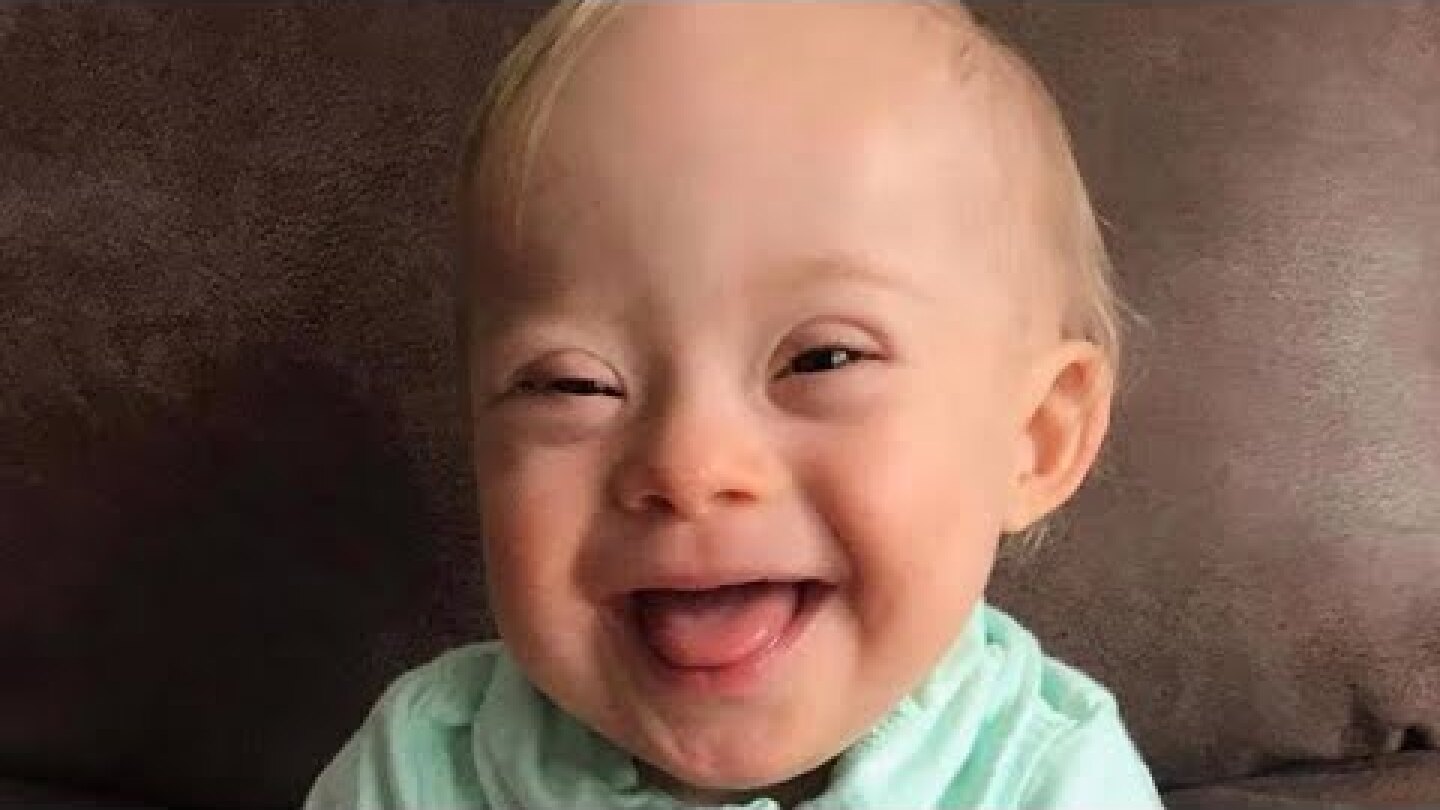 This Year's Gerber Baby Is the First With Down Syndrome