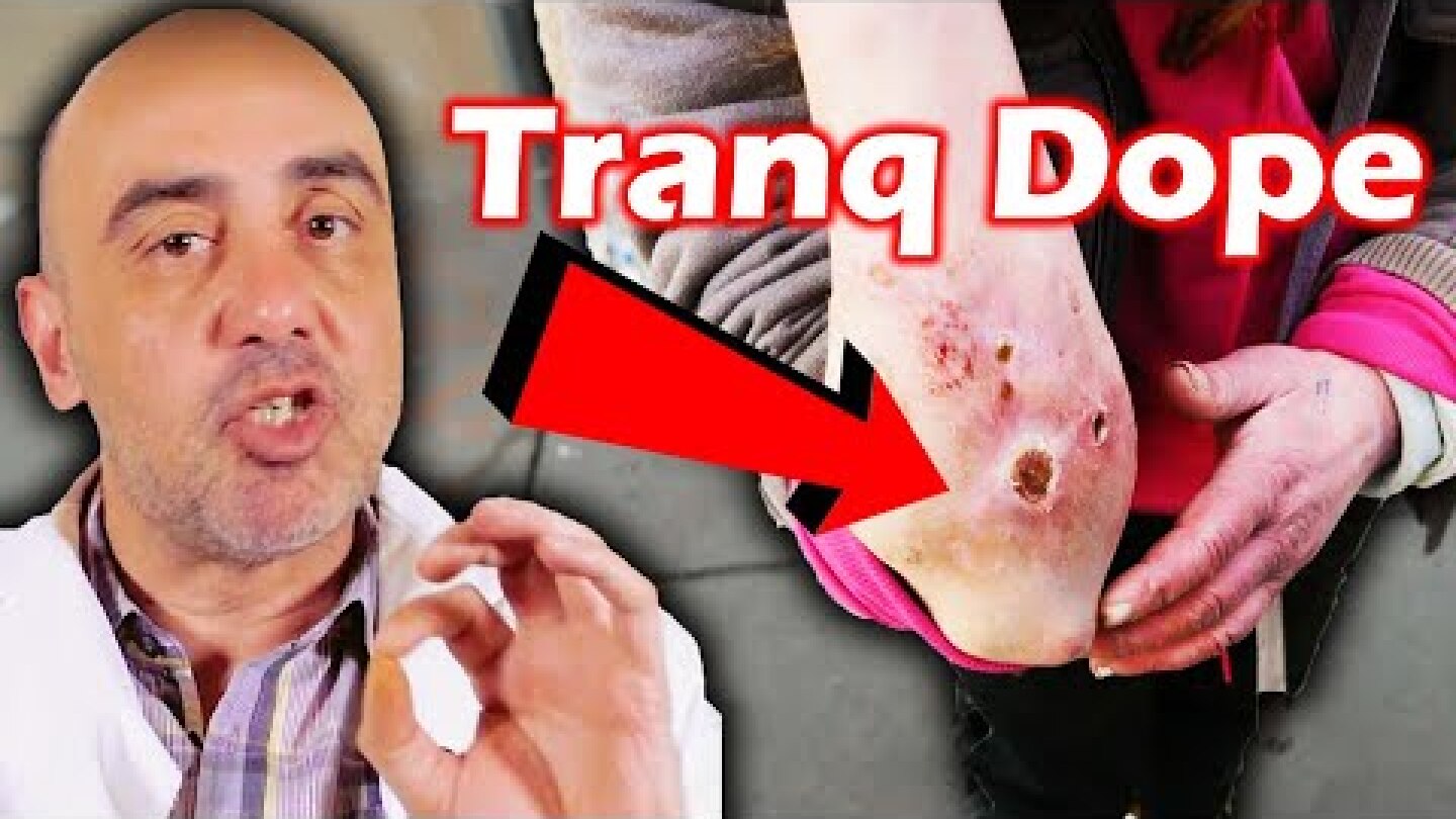 What Is Tranq Dope? The Dangerous New Drug On The Streets