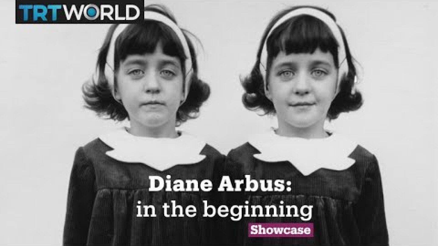 Diane Arbus: In the Beginning | Exhibitions | Showcase