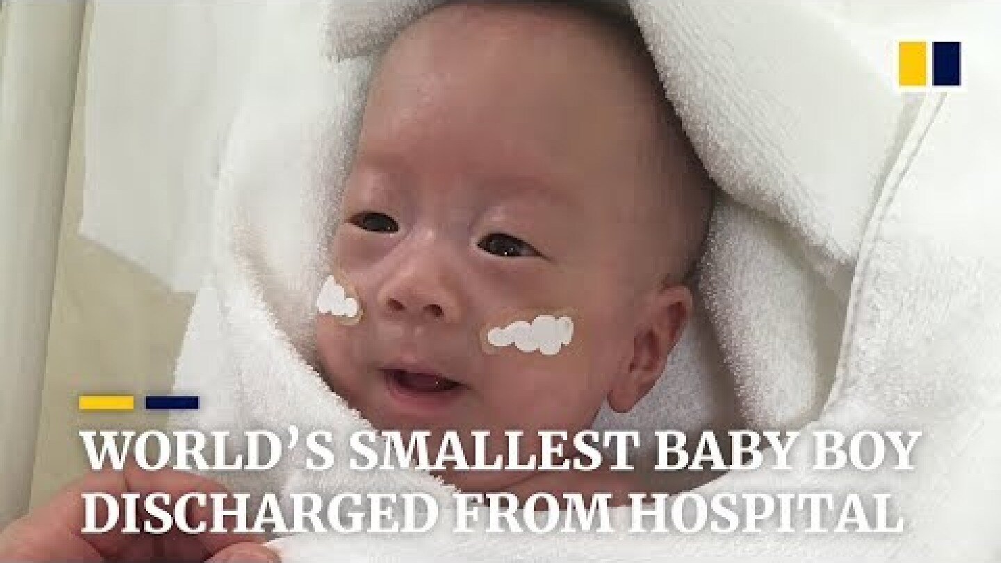 World's smallest baby boy discharged from hospital