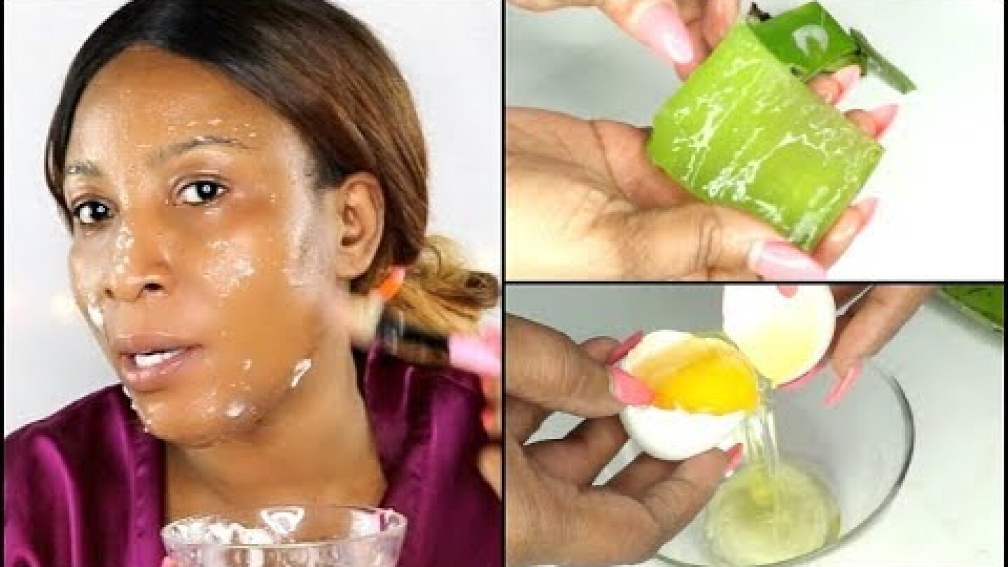NO JOKE USE EGG AND ALOE VERA, WATCH YOUR FACE TRANSFORM, Live Demo |Khichi Beauty