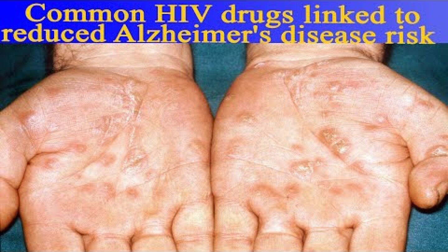 Common HIV drugs linked to reduced Alzheimer's disease risk