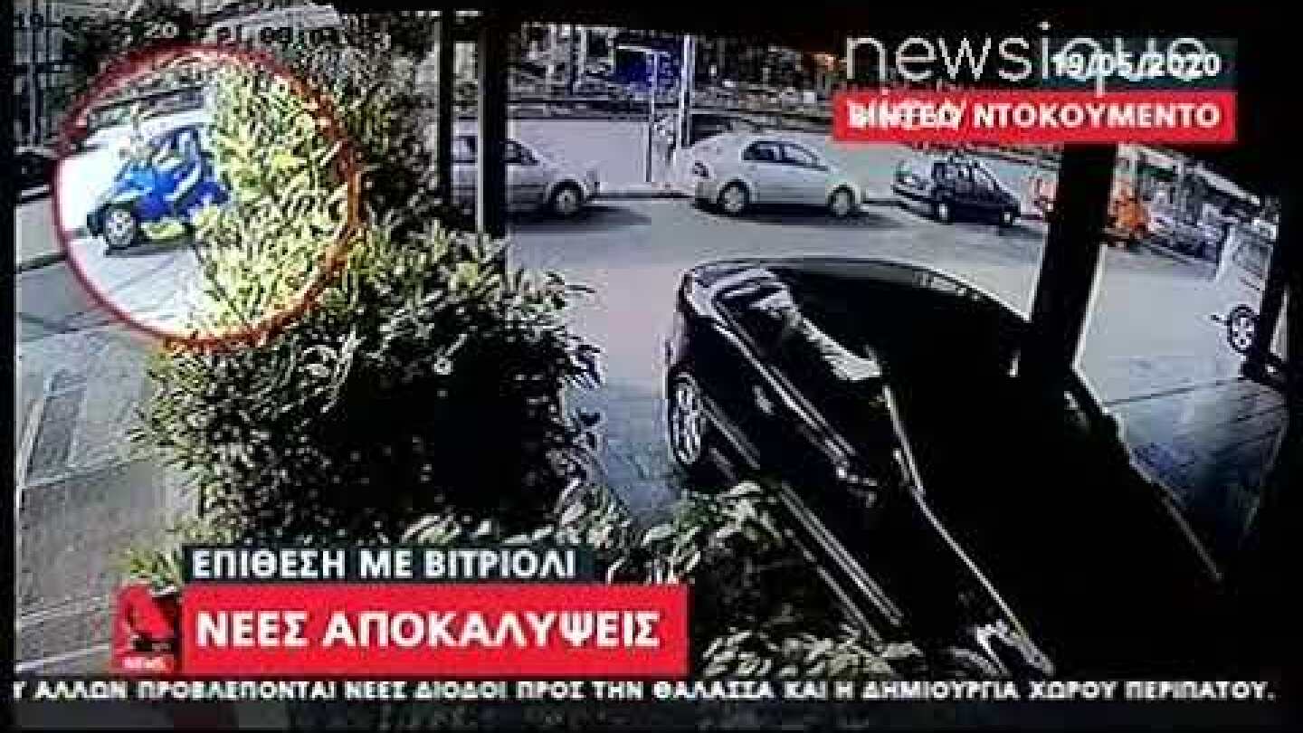 Βιτριόλι: Η 35χρονη χωρίς περούκα και μάσκα