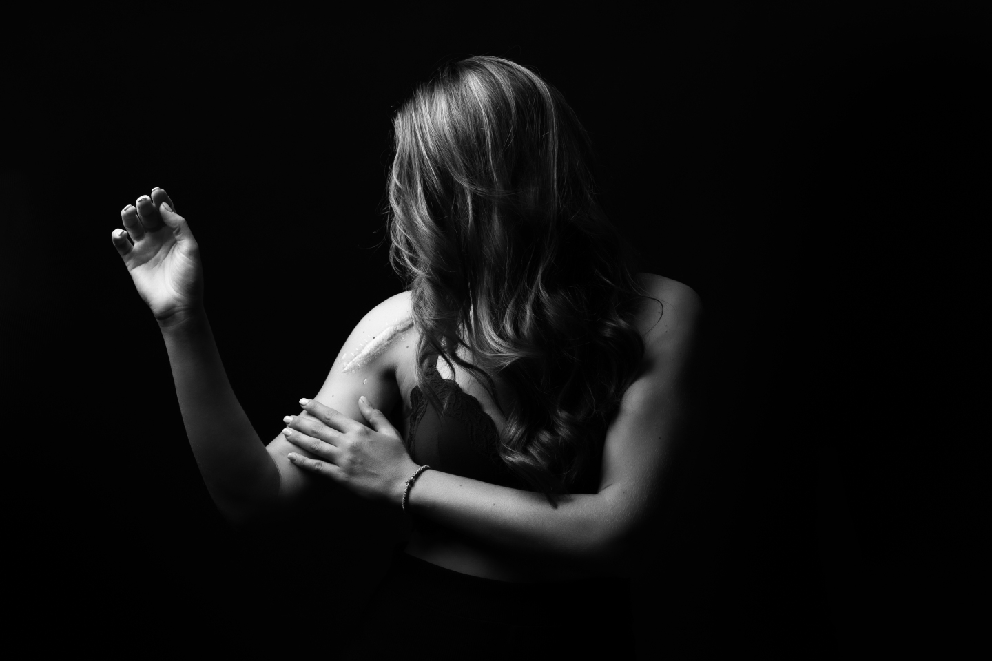 Ουλή από κάταγμα ώμου