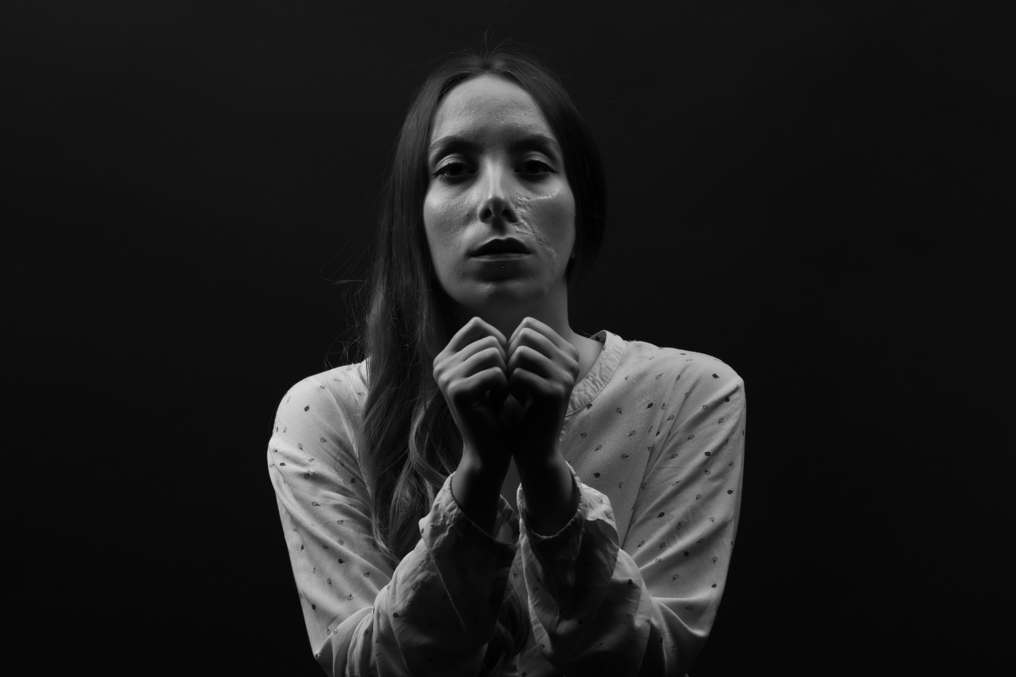 Ουλή από μελαγχρωματικό σπήλο