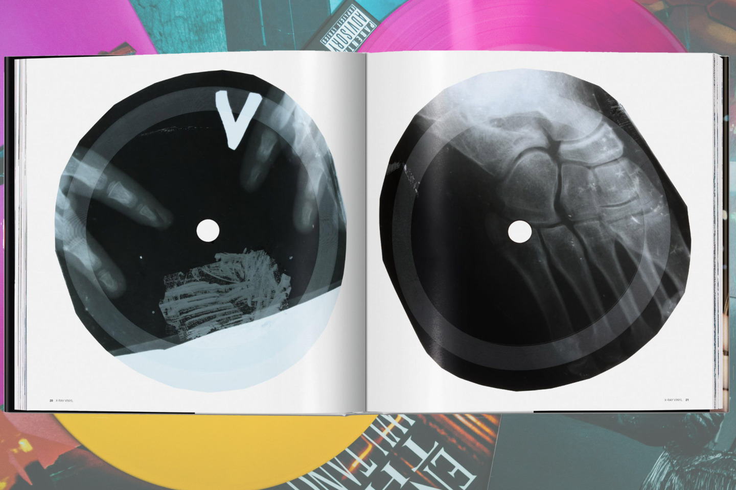 Extraordinary Records: X-RAY VINYL
