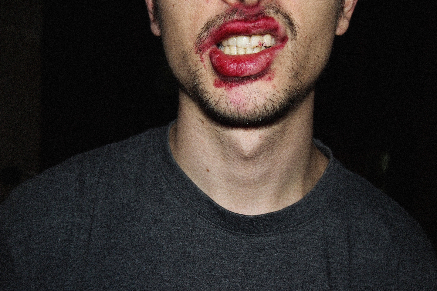 © Καρολίνα Κακοταρίτη 