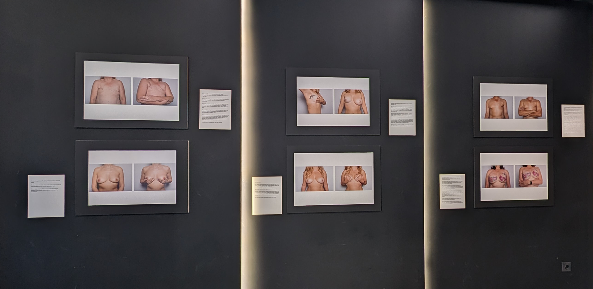 Σύλβια Κουβέλη: «Θέλω οι εκθέσεις του boobs να γίνουν αφορμή για να ανοίξει μια δύσκολη συζήτηση»