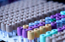 20 τα κρούσματα στην Ελλάδα που αφορούν στην ευλογιά των πιθήκων