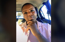 Η Aviwe Mazosiwe στη Νότια Αφρική «σφράγισε» το στόμα της με ειδική συσκευή για να μην τρώει