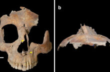 Βρέθηκε κρανίο με τετράγωνη τρύπα στο Ισραήλ