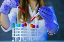 Συμφωνία συνεργασίας Ομίλου Chiesi με τη Haisco Pharmaceutical