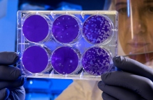 Επιστήμονες χρησιμοποίησαν κύτταρα από υγρό που αντλήθηκε κατά τη διάρκεια της εγκυμοσύνης για να αναπτύξουν μίνι πνεύμονες και άλλα όργανα