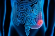 ακτινογραφια παχεος εντερου