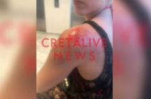 Κρήτη: Οδηγός φωτογράφισε κρυφά τα οπίσθια 25χρονης, την χτύπησε με το μηχανάκι και την έσυρε στο οδόστρωμα