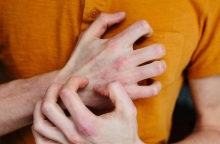 Κόκκινα σημάδια στο δέρμα: Η προειδοποίηση των γιατρών 