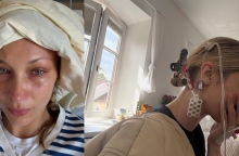 Η σιωπηλή ασθένεια της Μπέλα Χαντίντ: Το χρονικό της μάχης με τη νόσο του Lyme