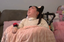 Γυναίκα που γεννήθηκε σχεδόν χωρίς εγκέφαλο έκλεισε τα 20 - Οι γιατροί της έδιναν 4 χρόνια ζωής