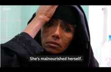 Yemen Could Be 'Worst Famine In 100 Years'