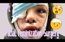 Facial Feminization Surgery - Day 1 & 2 (GRAPHIC) | Stef Sanjati