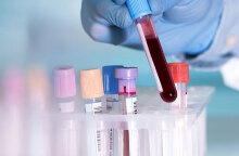 Τεστ αίματος