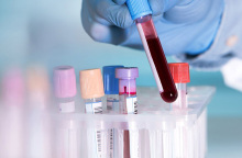 Εξέταση αίματος