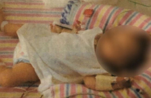 Γονείς υπέβαλαν σε αυστηρή vegan διατροφή την 19 μηνών κόρη τους 