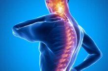 ankylosing-spondylitis.jpg