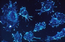 cancer-cells-541954_1920.jpg