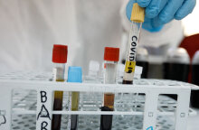 Κορωνοϊός στην Ελλάδα