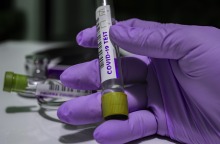 Η COVID-19 αυξάνει τον κίνδυνο θρόμβωσης;