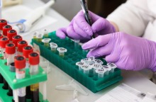 Εμπόδια στην πρόσβαση ασθενών με HIV στις απαραίτητες εξετάσεις 