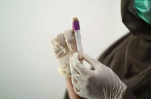 Κλινική μελέτη για τον κορωνοϊό και τη θεραπεία κατά της Covid-19 (ΦΩΤΟ ΑΡΧΕΙΟΥ)