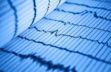 Καρδιογράφημα