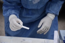 ΕΟΔΥ - Τεστ για κορωνοϊό