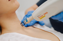 Φακίδες και θεραπείες