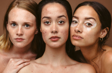 Ποιες παθήσεις αποχρωματίζουν την επιδερμίδα;