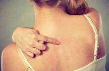 Δερματικό εξάνθημα