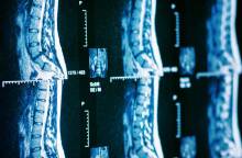 Εφαρμογή της ρομποτικής χειρουργικής της σπονδυλικής στήλης