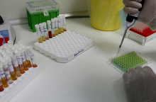 Κορωνοϊός: «Κάτω από τα 60 ευρώ το PCR test»