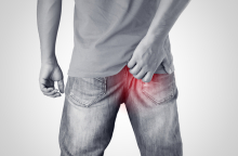 Βοηθάει η αποτρίχωση με λέιζερ στην κύστη κόκκυγα;