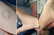 Άρτα: Διευθύντρια σχολείου δάγκωσε παιδί με αυτισμό