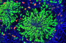 Νευρογένεση και Μνήμη